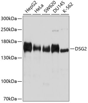 DSG2 Rabbit Polyclonal Antibody