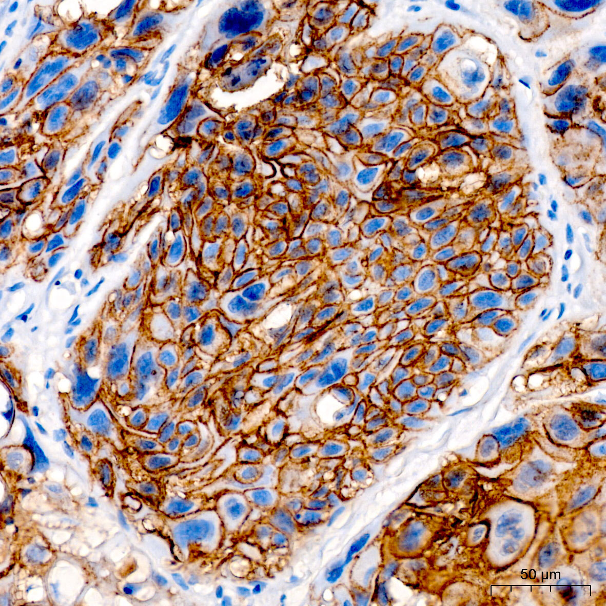 DSG3/Desmoglein-3 Rabbit Polyclonal Antibody