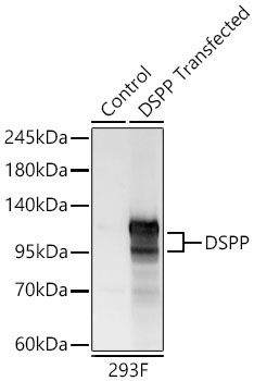 DSPP Rabbit Polyclonal Antibody