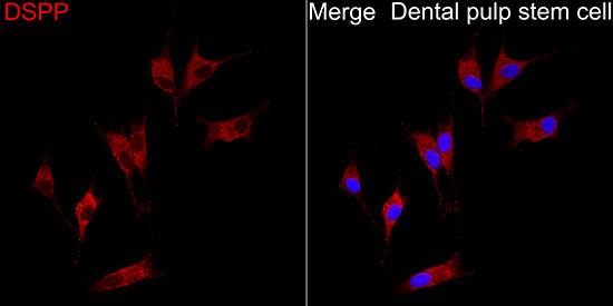 DSPP Rabbit Polyclonal Antibody - Image 2