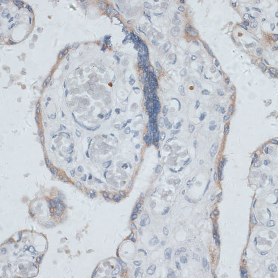 DTNBP1 Rabbit Polyclonal Antibody