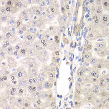 DTX2 Rabbit Polyclonal Antibody - Image 2