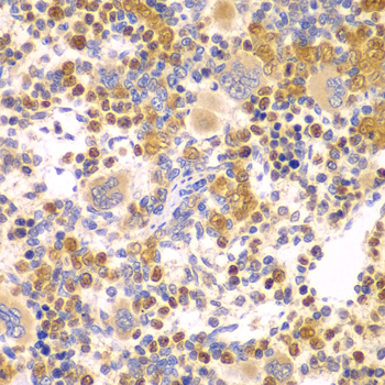 DTX2 Rabbit Polyclonal Antibody - Image 3