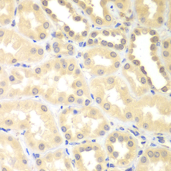 DTX2 Rabbit Polyclonal Antibody - Image 4
