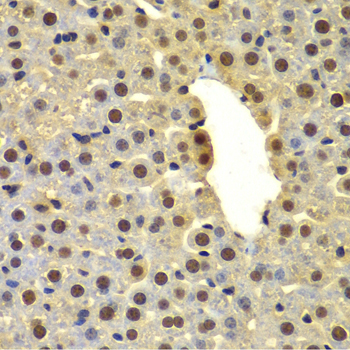 DTX2 Rabbit Polyclonal Antibody - Image 5