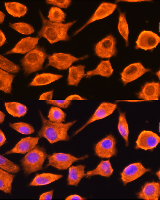 DTYMK Rabbit Polyclonal Antibody - Image 2
