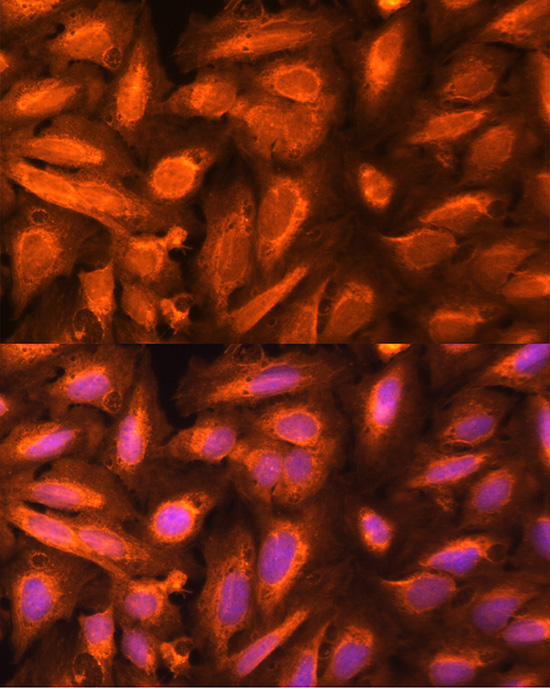 DTYMK Rabbit Polyclonal Antibody - Image 3