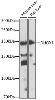 DUOX1 Rabbit Polyclonal Antibody