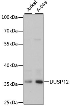 DUSP12 Rabbit Polyclonal Antibody