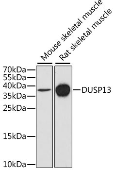 DUSP13 Rabbit Polyclonal Antibody