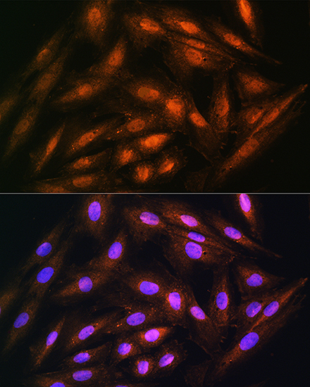 DUSP14 Rabbit Polyclonal Antibody - Image 2