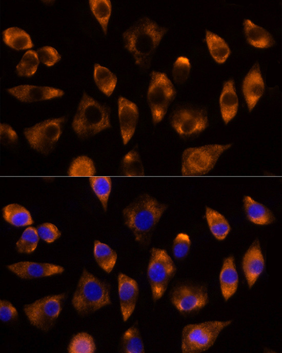 DUSP15 Rabbit Polyclonal Antibody - Image 2