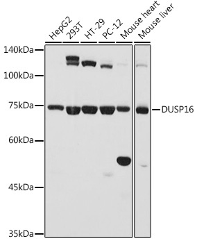 DUSP16 Rabbit Polyclonal Antibody
