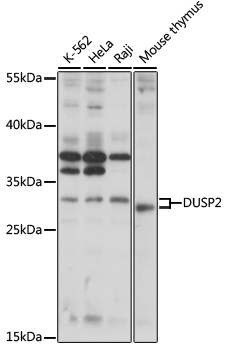 DUSP2 Rabbit Polyclonal Antibody