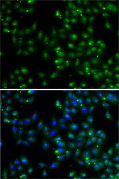 DUSP22 Rabbit Polyclonal Antibody - Image 2