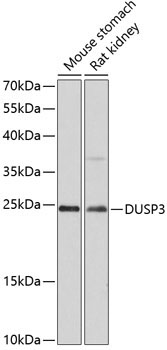DUSP3 Rabbit Polyclonal Antibody