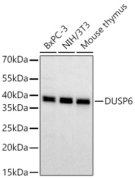 DUSP6 Rabbit Monoclonal Antibody