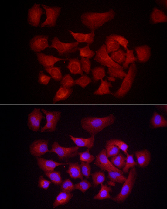 DUSP8 Rabbit Polyclonal Antibody - Image 2