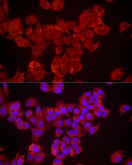 DUSP8 Rabbit Polyclonal Antibody - Image 3