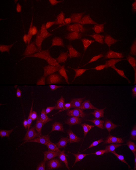 DUSP8 Rabbit Polyclonal Antibody - Image 4