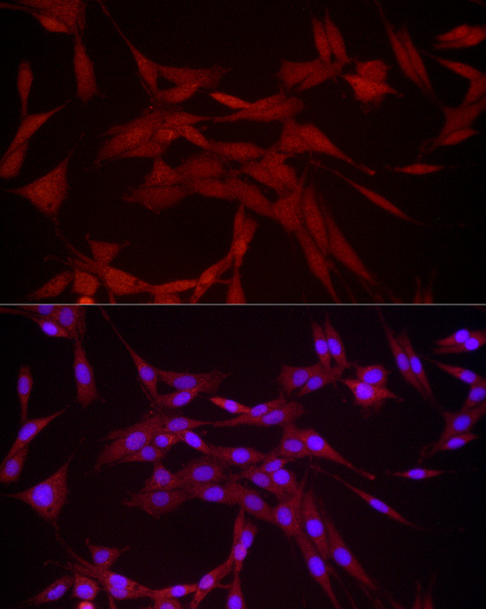 DUSP8 Rabbit Polyclonal Antibody - Image 5