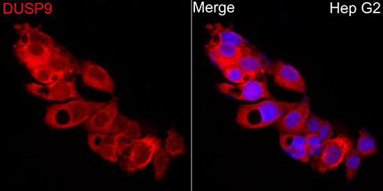 DUSP9 Rabbit Polyclonal Antibody
