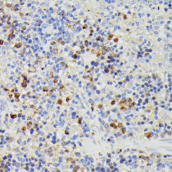 DUT Rabbit Polyclonal Antibody - Image 2