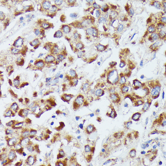 DUT Rabbit Polyclonal Antibody - Image 3