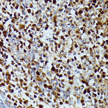DUT Rabbit Polyclonal Antibody - Image 4