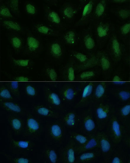 DUT Rabbit Polyclonal Antibody - Image 5