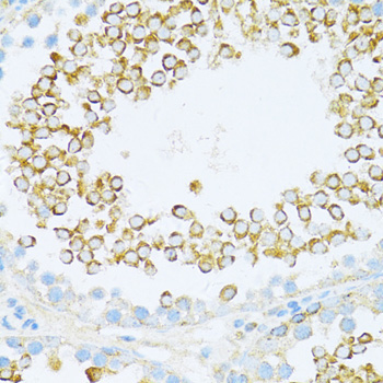 DVL1 Rabbit Polyclonal Antibody - Image 2