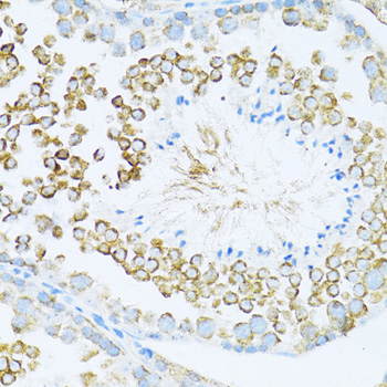 DVL1 Rabbit Polyclonal Antibody - Image 3