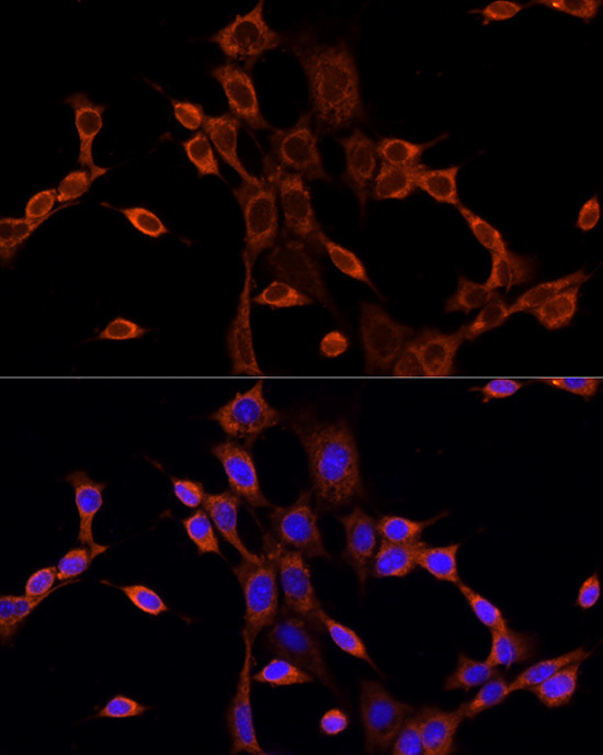 DVL1 Rabbit Polyclonal Antibody - Image 4