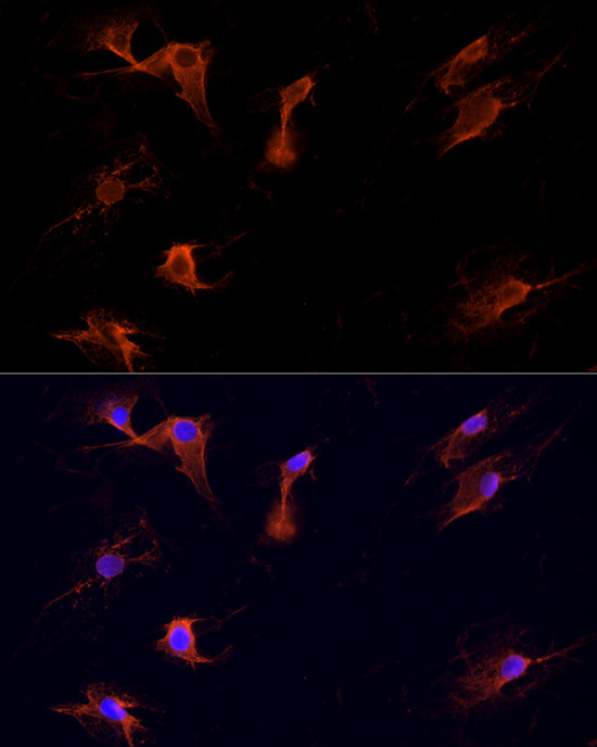 DVL1 Rabbit Polyclonal Antibody - Image 5