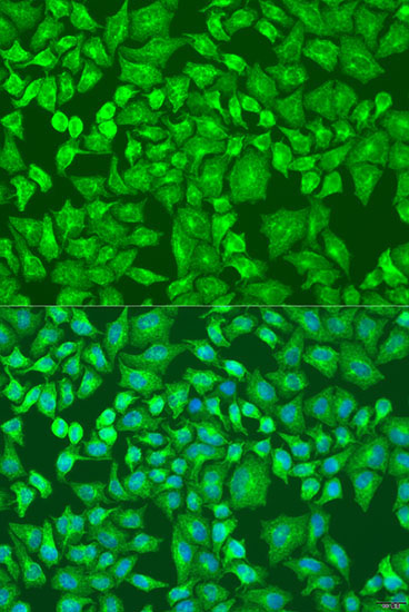 DVL2 Rabbit Polyclonal Antibody