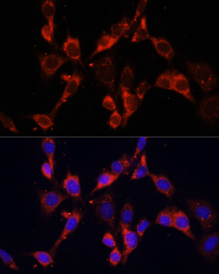 DVL2 Rabbit Polyclonal Antibody