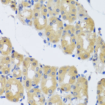 DYNC1I1 Rabbit Polyclonal Antibody - Image 2
