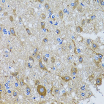 DYNC1I1 Rabbit Polyclonal Antibody - Image 3