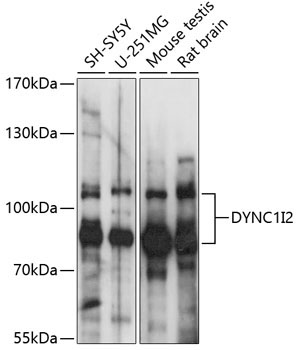 DYNC1I2 Rabbit Polyclonal Antibody