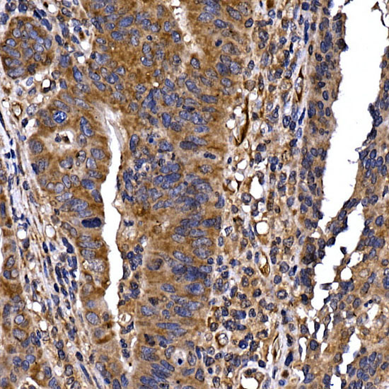 DYNC1LI2 Rabbit Polyclonal Antibody - Image 2