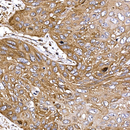 DYNC1LI2 Rabbit Polyclonal Antibody - Image 3