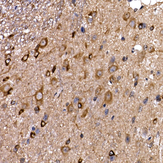 DYNC1LI2 Rabbit Polyclonal Antibody - Image 4