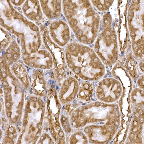 DYNC1LI2 Rabbit Polyclonal Antibody - Image 5