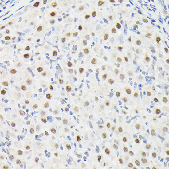 DYNLL1 Rabbit Polyclonal Antibody - Image 2
