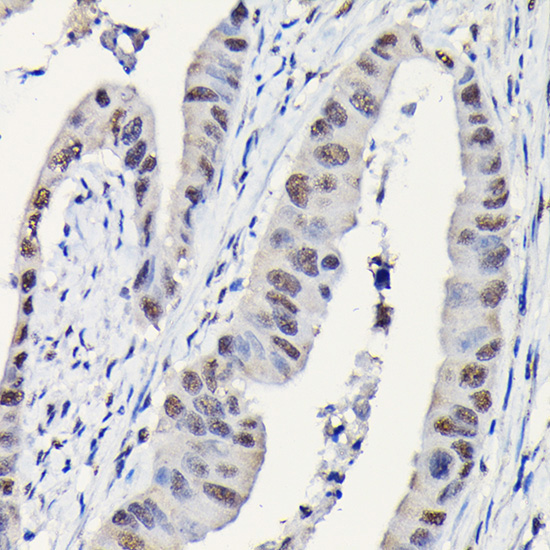 DYNLL1 Rabbit Polyclonal Antibody - Image 3
