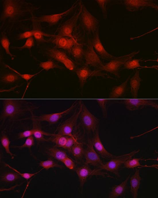 DYNLL1 Rabbit Polyclonal Antibody - Image 5