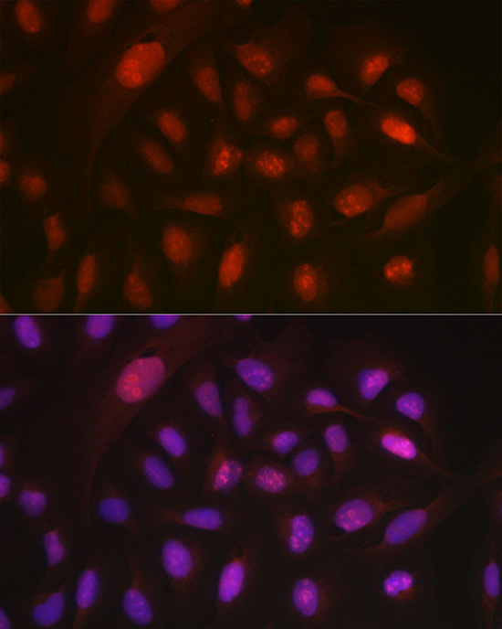 DYNLL1 Rabbit Polyclonal Antibody - Image 7