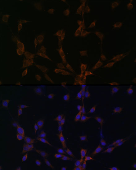 DYNLL2 Rabbit Polyclonal Antibody - Image 2