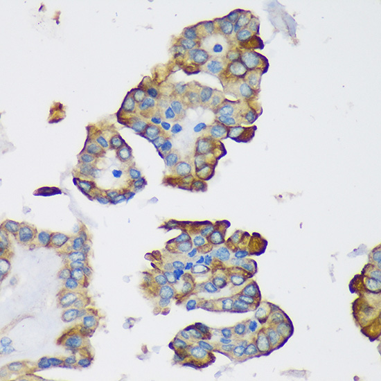 DYNLRB1 Rabbit Polyclonal Antibody - Image 2