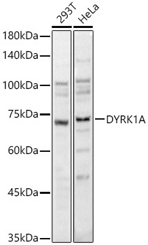 DYRK1A Rabbit Polyclonal Antibody